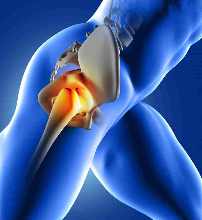 Hip Replacement Surgery 